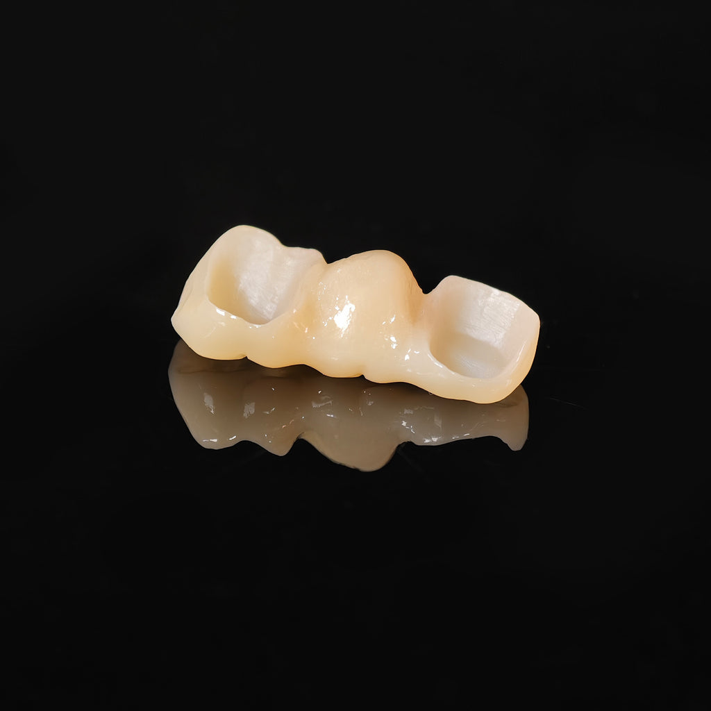 High - Strength Zirconia Bridge