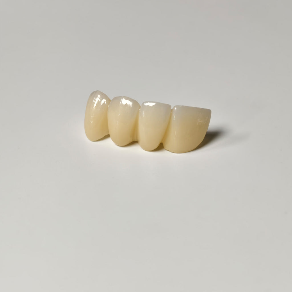 High - Strength Zirconia Bridge