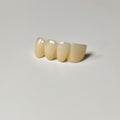 High - Strength Zirconia Bridge