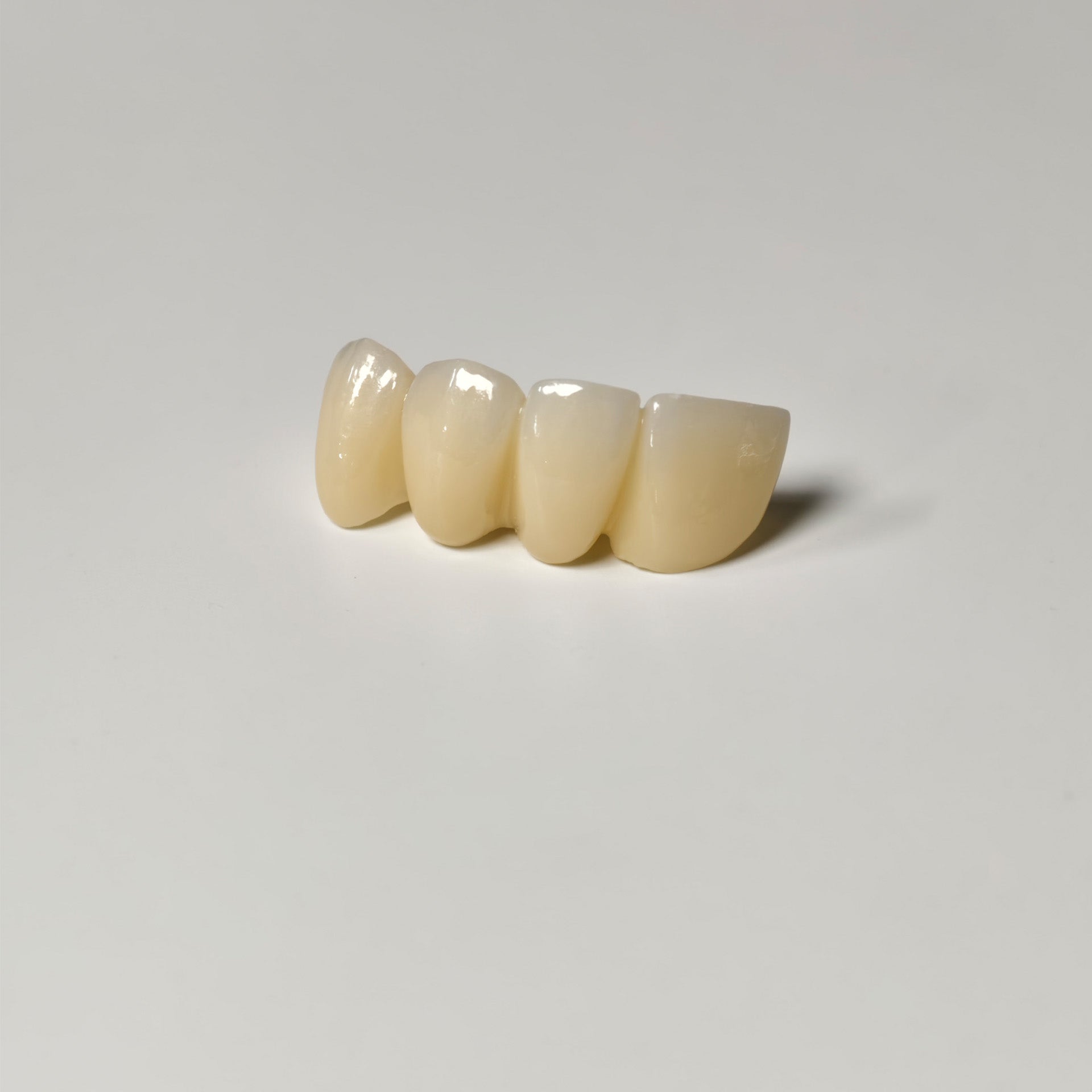 High - Strength Zirconia Bridge