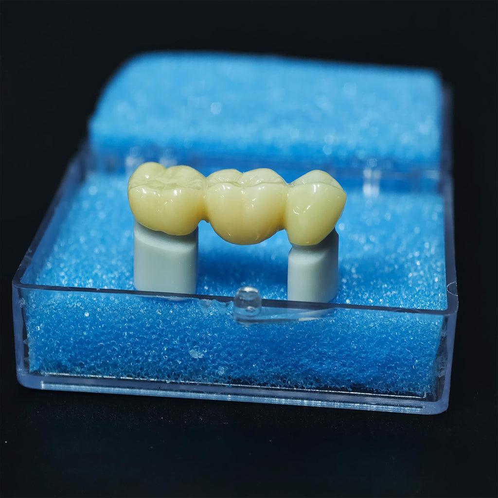 High - Strength Zirconia Bridge