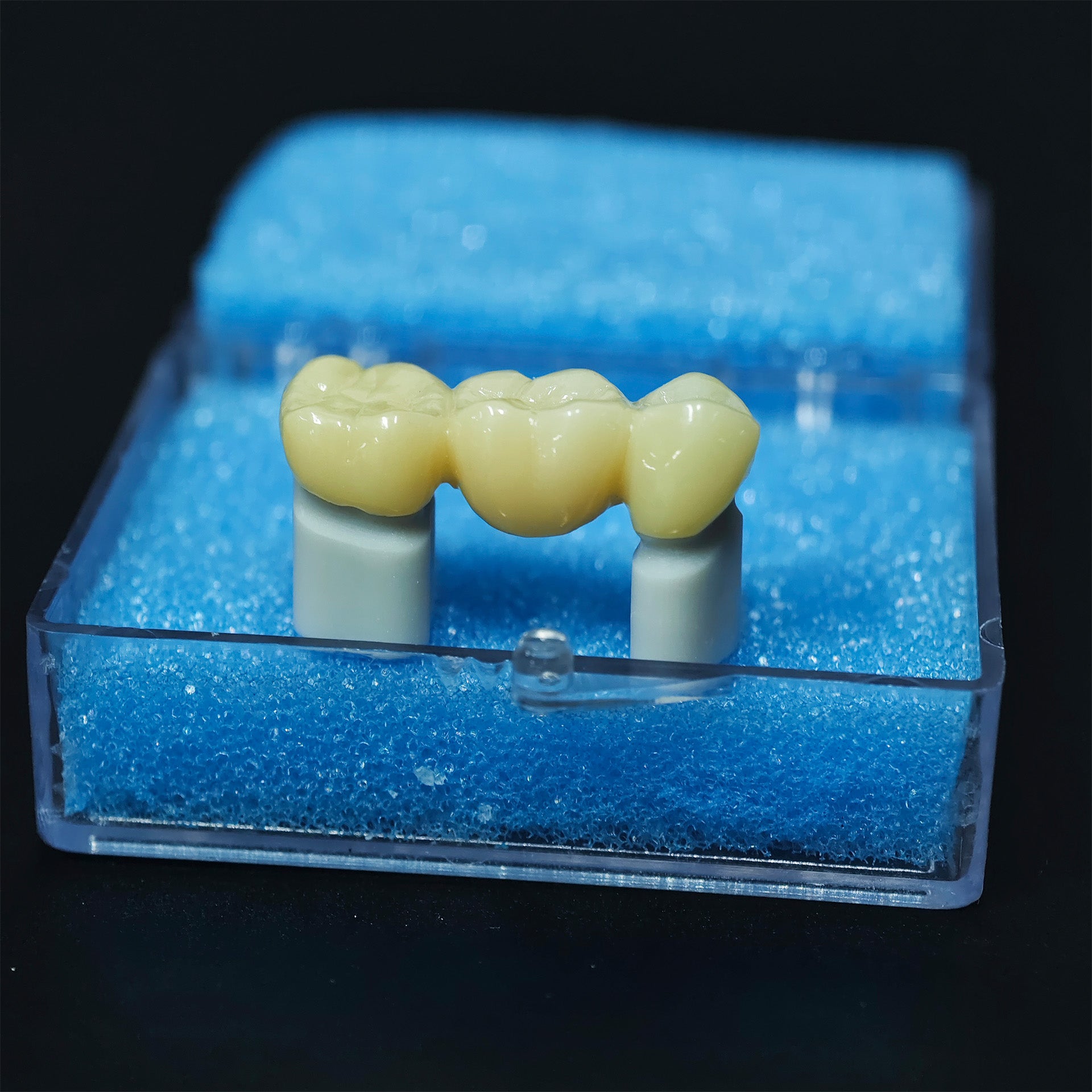 High - Strength Zirconia Bridge