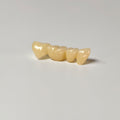 High - Strength Zirconia Bridge