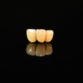 High - Strength Zirconia Bridge