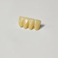 High - Strength Zirconia Bridge