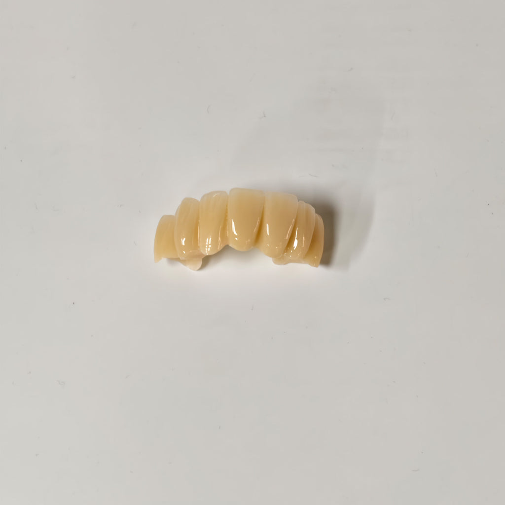 High - Strength Zirconia Bridge