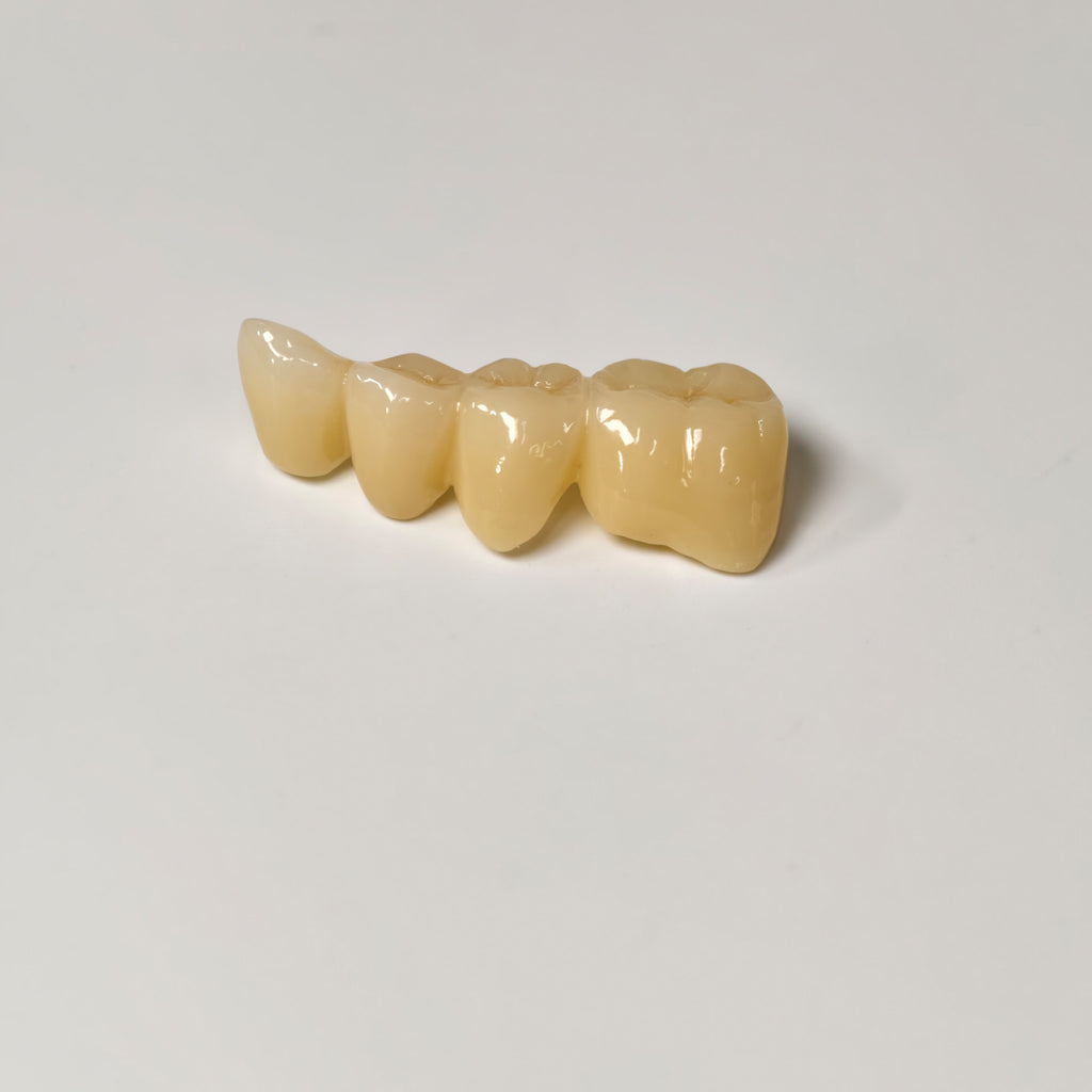 High - Strength Zirconia Bridge