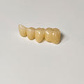 High - Strength Zirconia Bridge