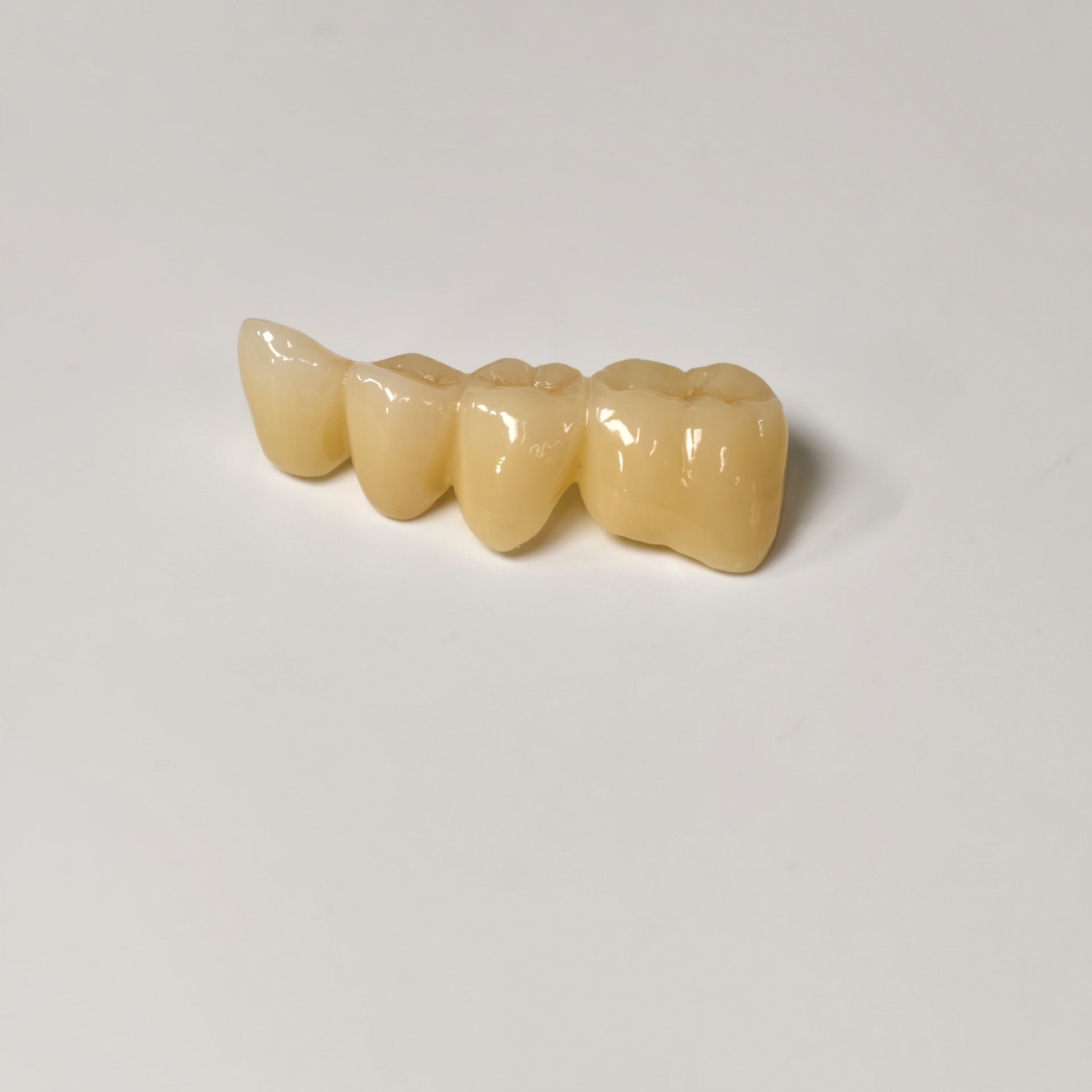 High - Strength Zirconia Bridge