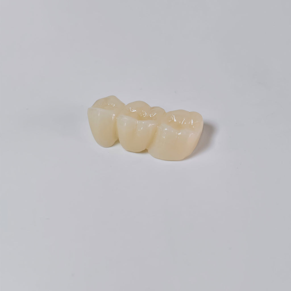 High - Strength Zirconia Bridge