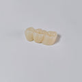 High - Strength Zirconia Bridge