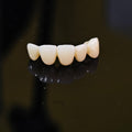 High - Strength Zirconia Bridge