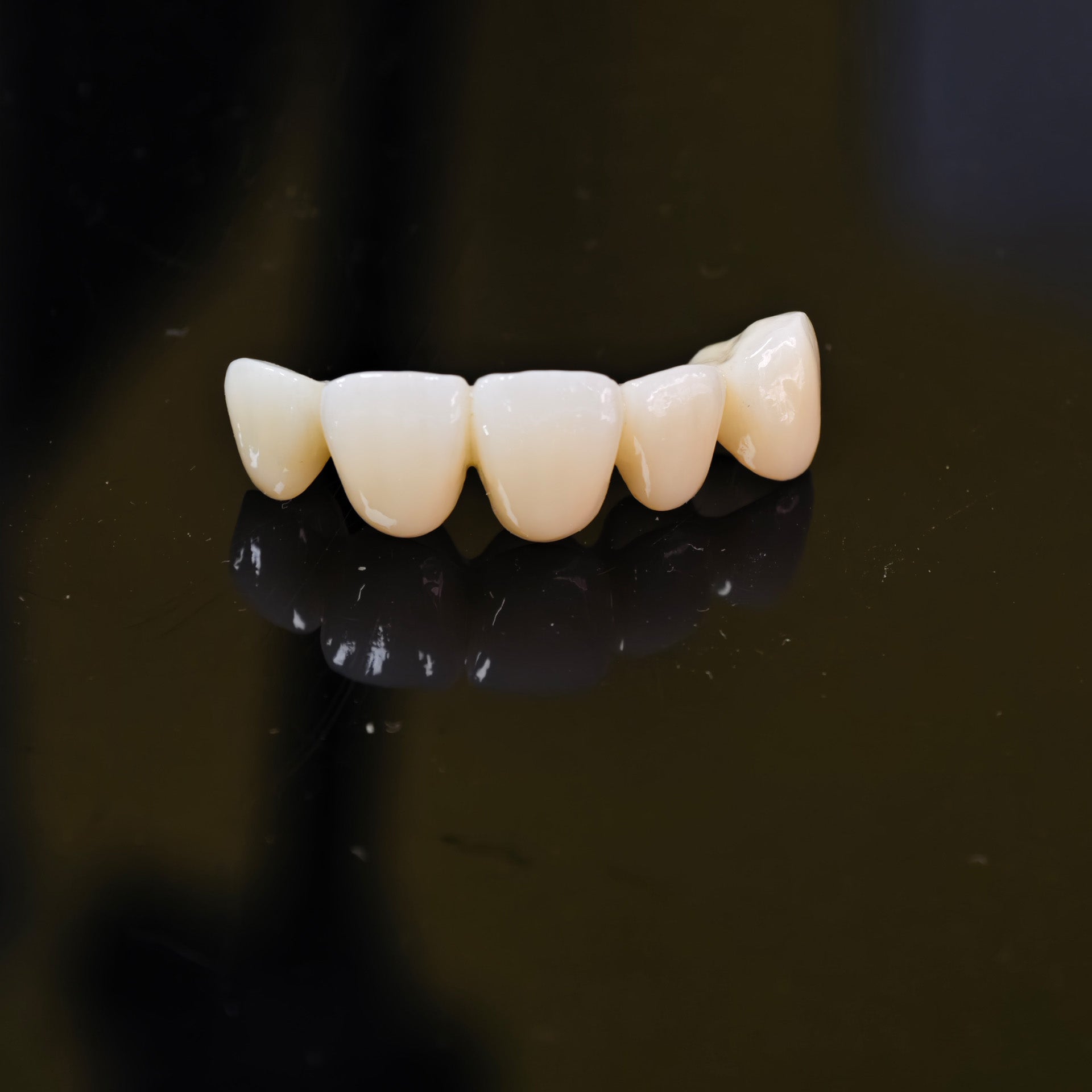 High - Strength Zirconia Bridge