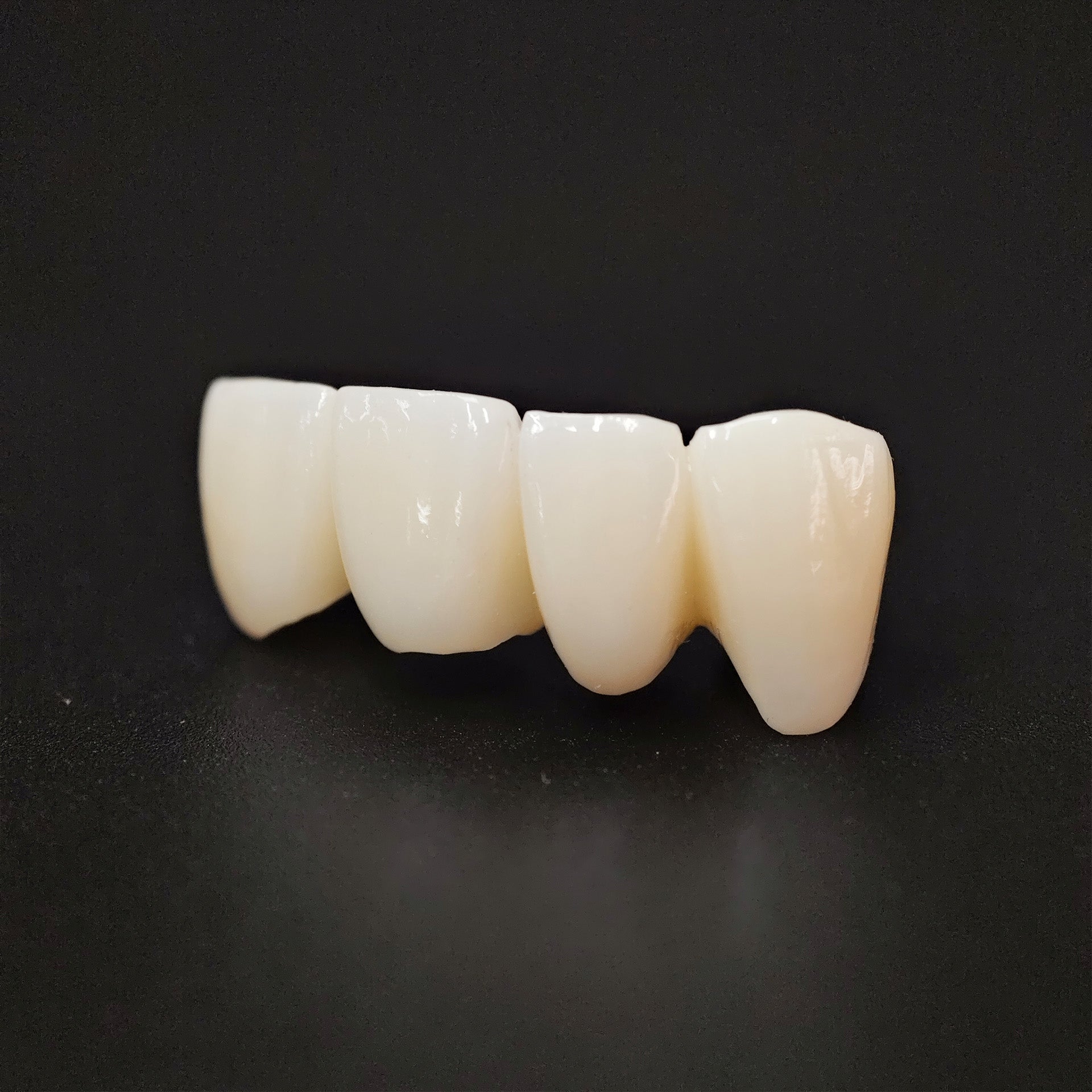 High - Strength Zirconia Bridge