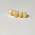 High - Strength Zirconia Bridge