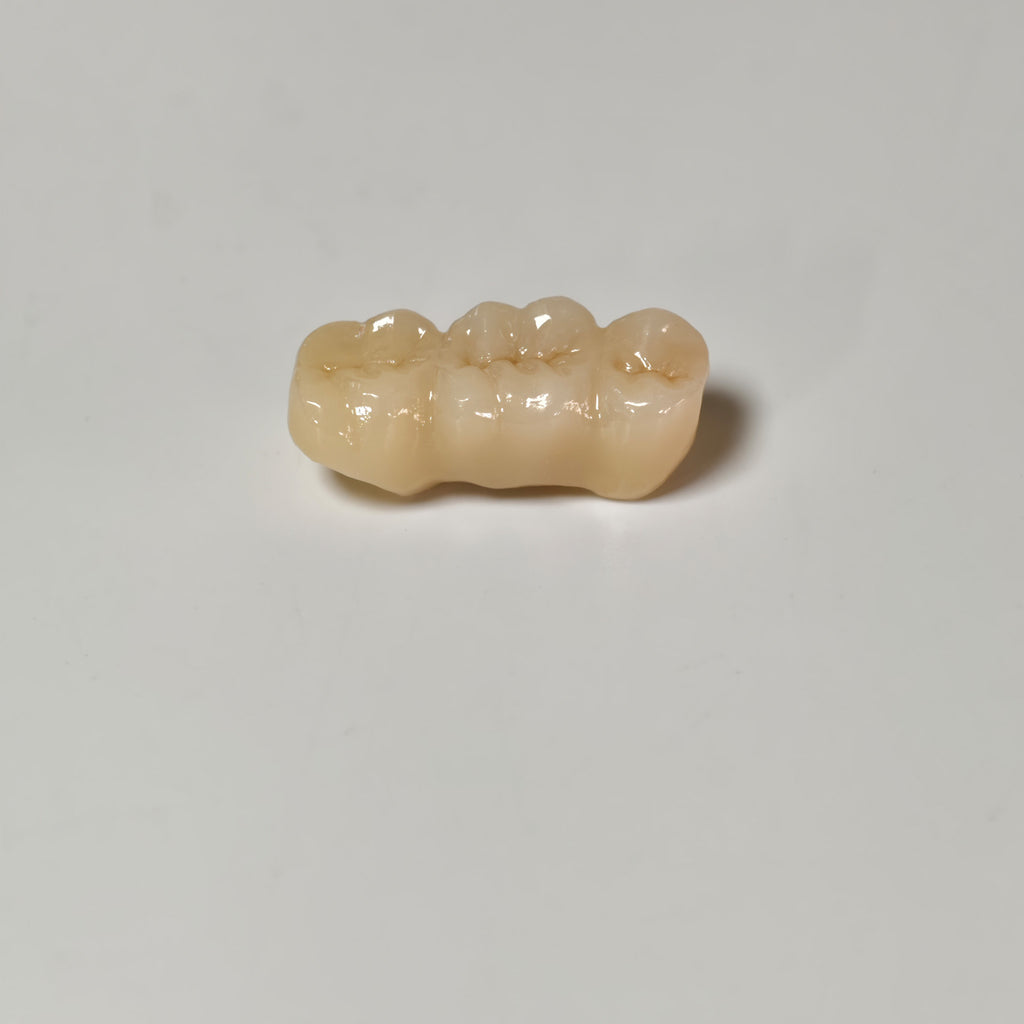 High - Strength Zirconia Bridge
