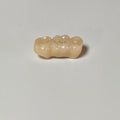 High - Strength Zirconia Bridge
