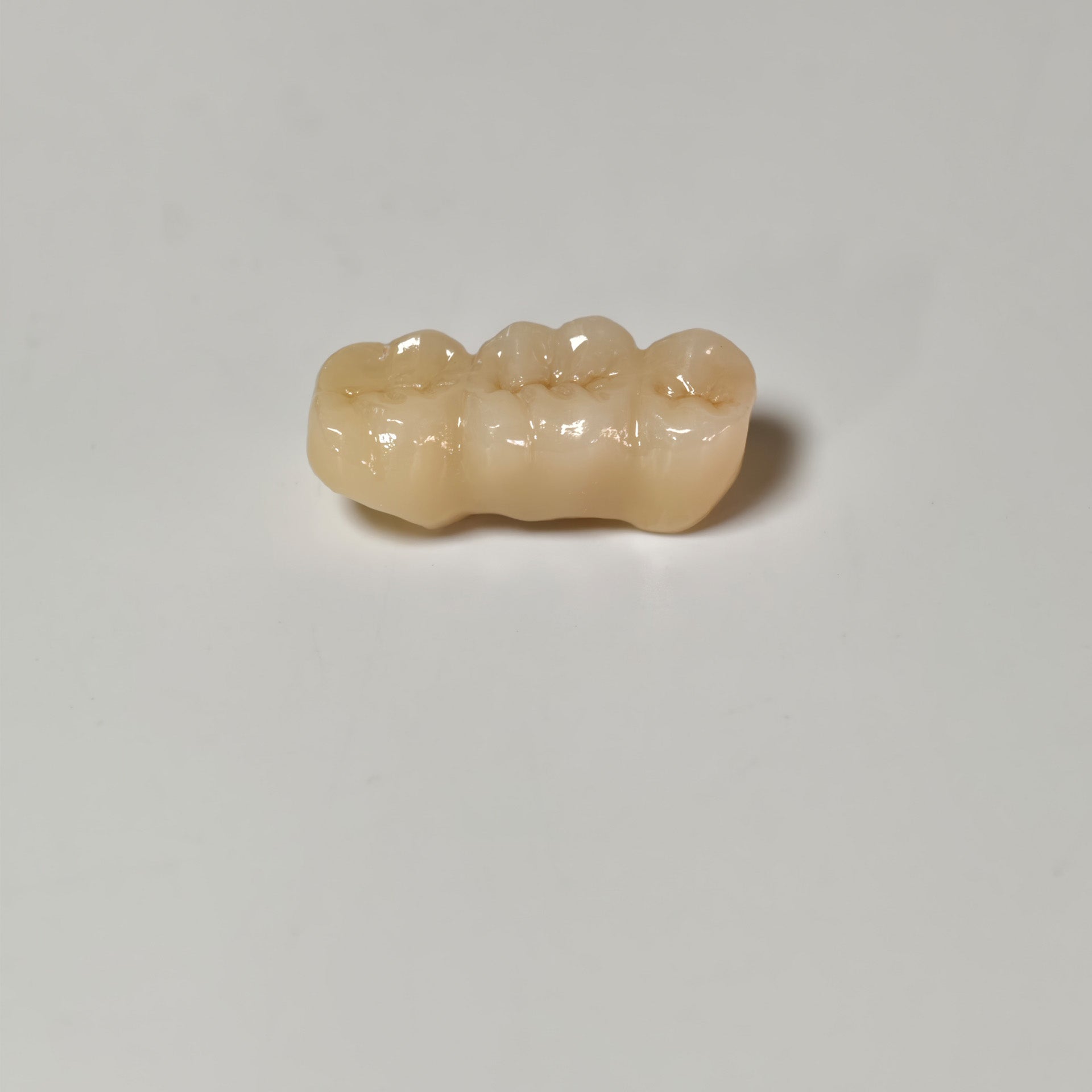 High - Strength Zirconia Bridge