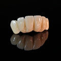 High - Strength Zirconia Bridge