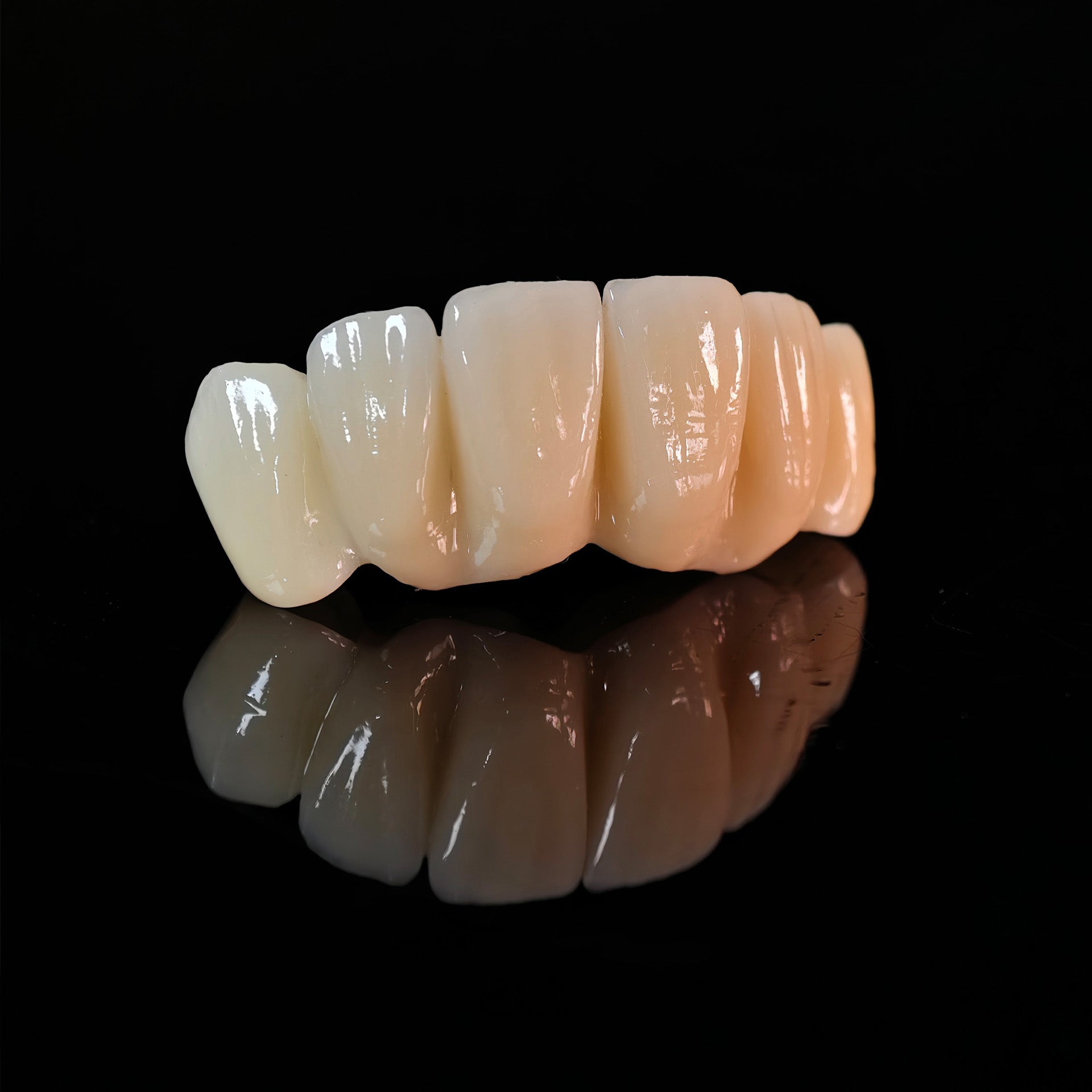 High - Strength Zirconia Bridge