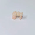 High - Strength Zirconia Bridge
