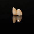 High - Strength Zirconia Bridge