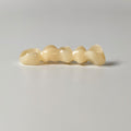 High - Strength Zirconia Bridge