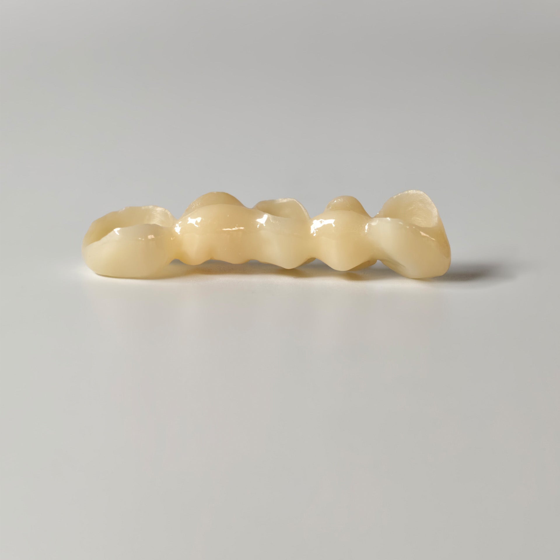 High - Strength Zirconia Bridge