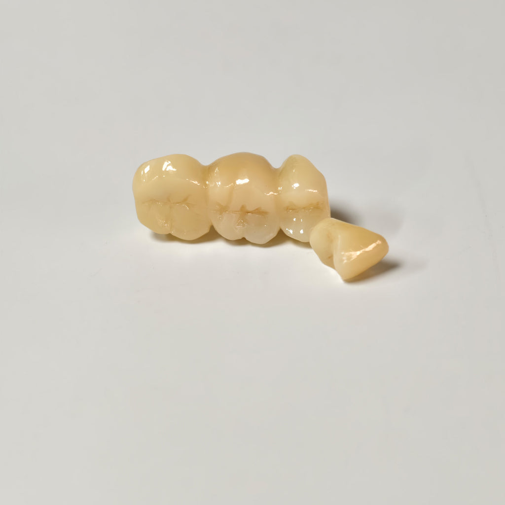 High - Strength Zirconia Bridge And Crown