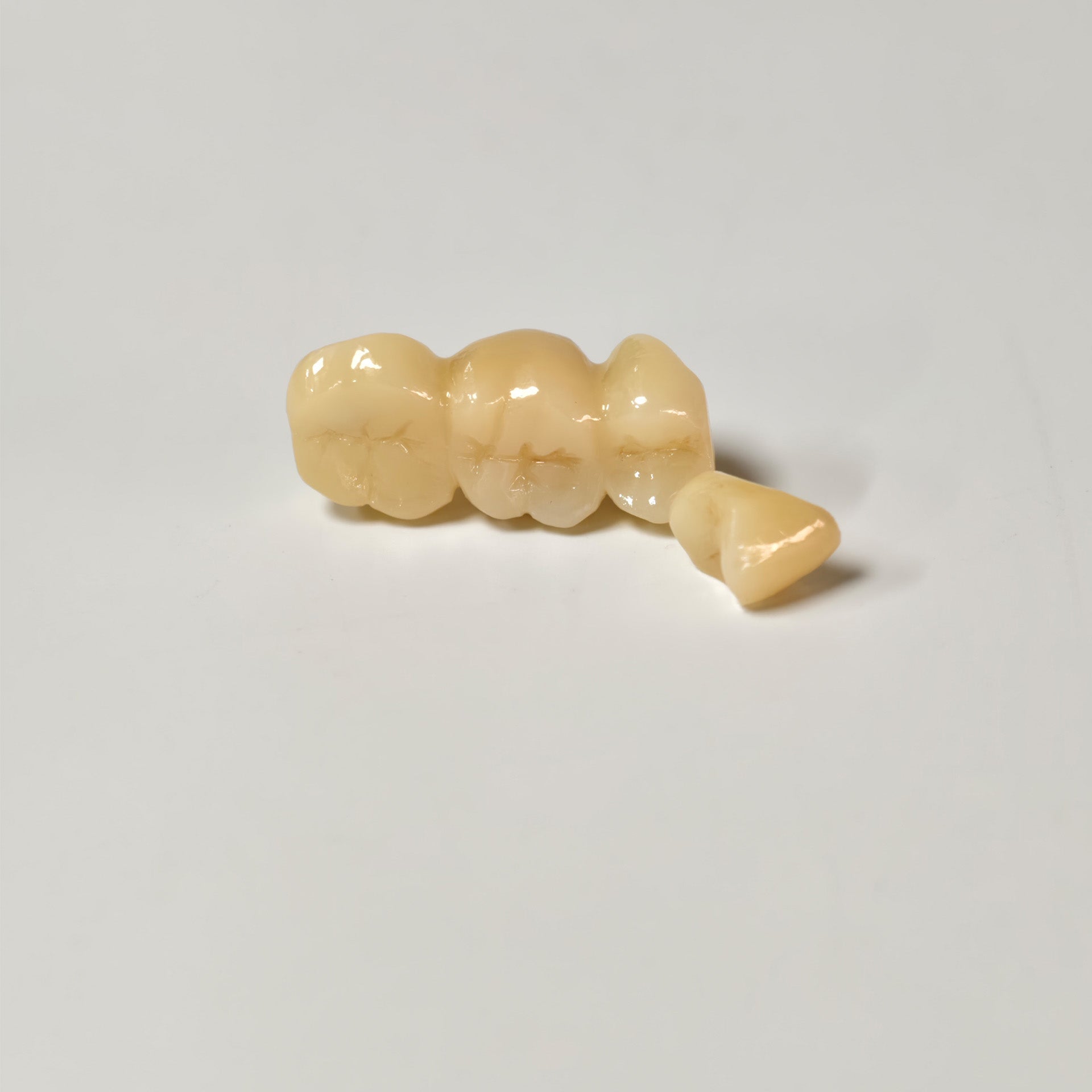 High - Strength Zirconia Bridge And Crown