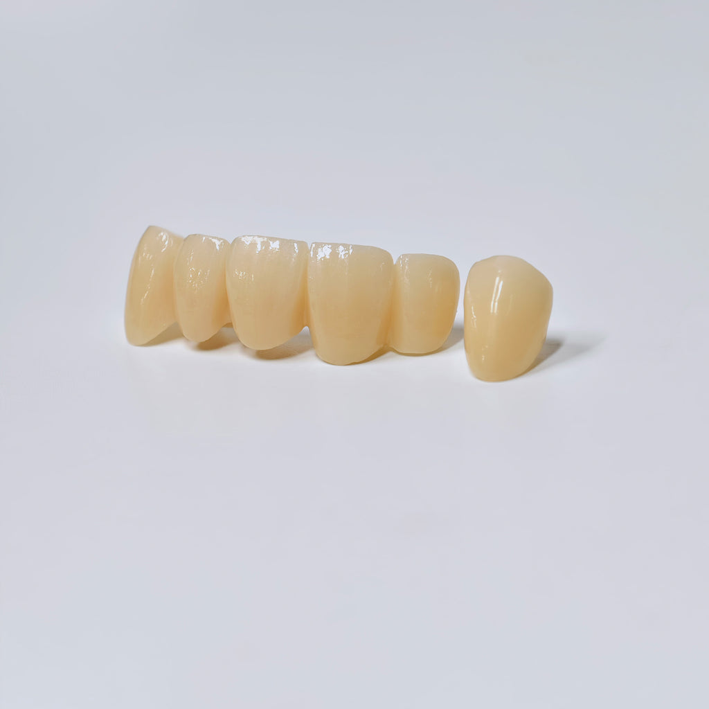 High - Strength Zirconia Crown And Bridge