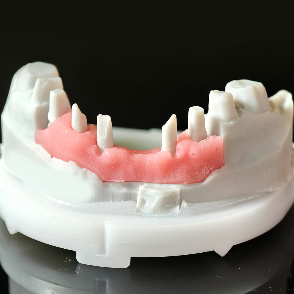 High - Strength Zirconia Crowns And Bridge
