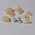 High - Strength Zirconia Crown with Post and core