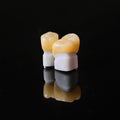 High - Strength Zirconia Dental Crowns
