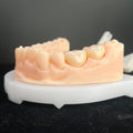 High - Strength Zirconia Dental Crowns