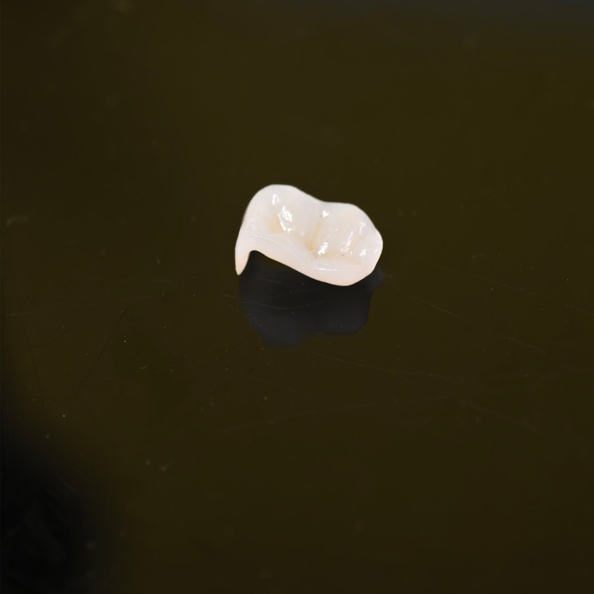 High - Strength Zirconia Inlay And Crown