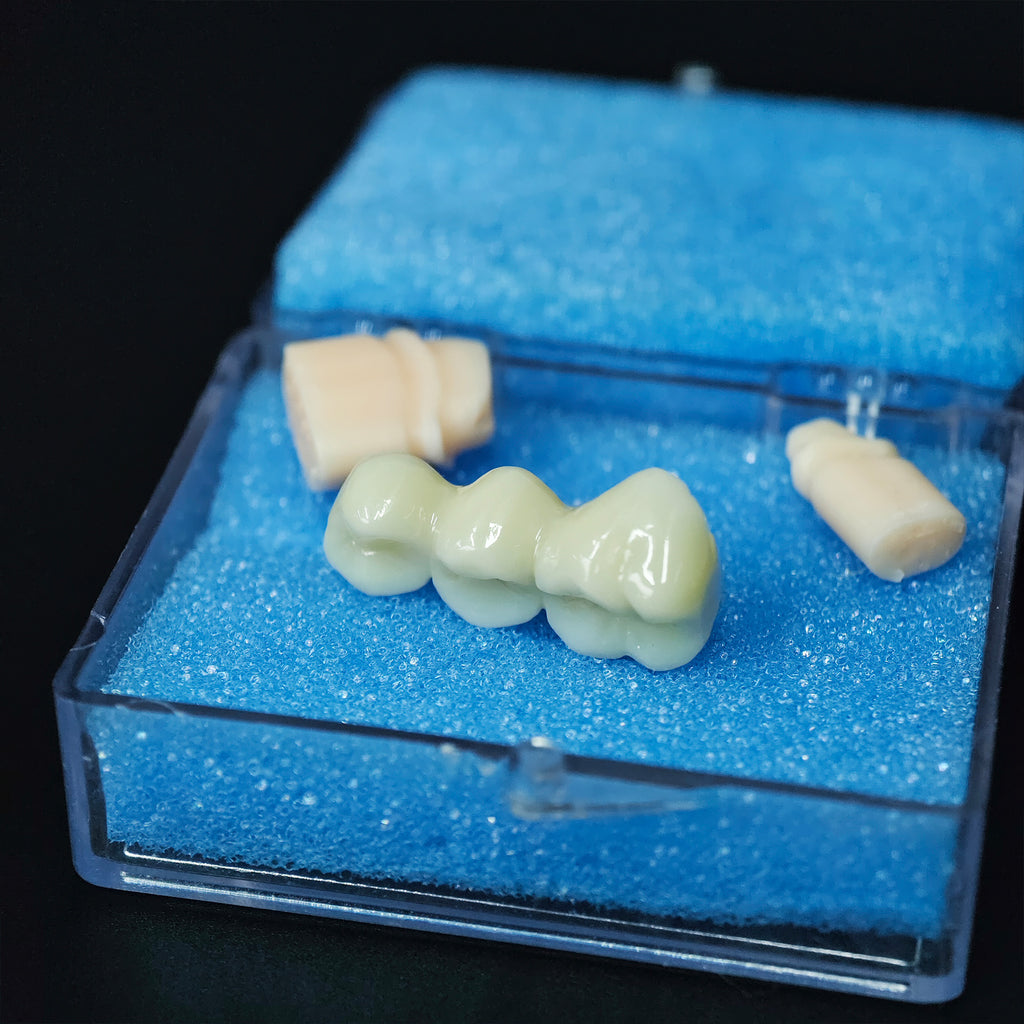 High - Strength Zirconia Bridge