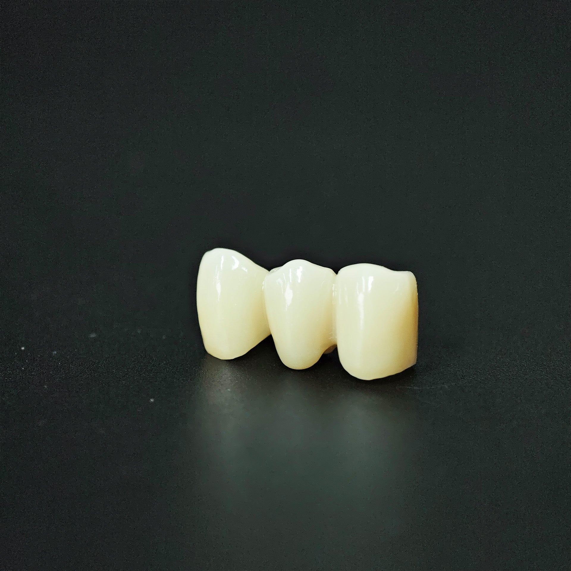 High - Strength Zirconia Bridge