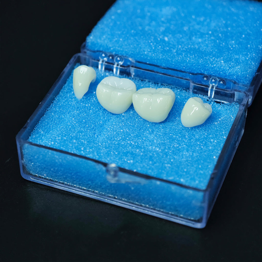 High - Strength Zirconia Crowns