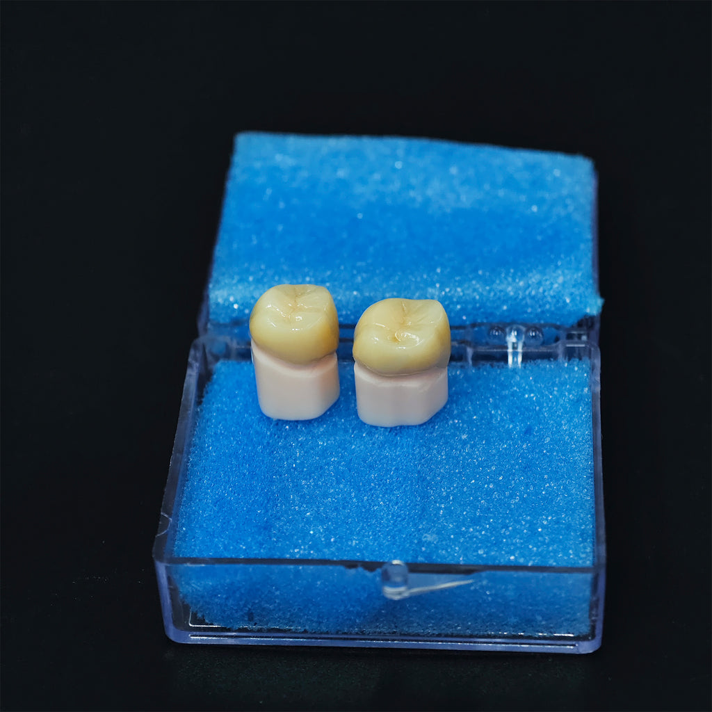 High - Strength Zirconia Crowns