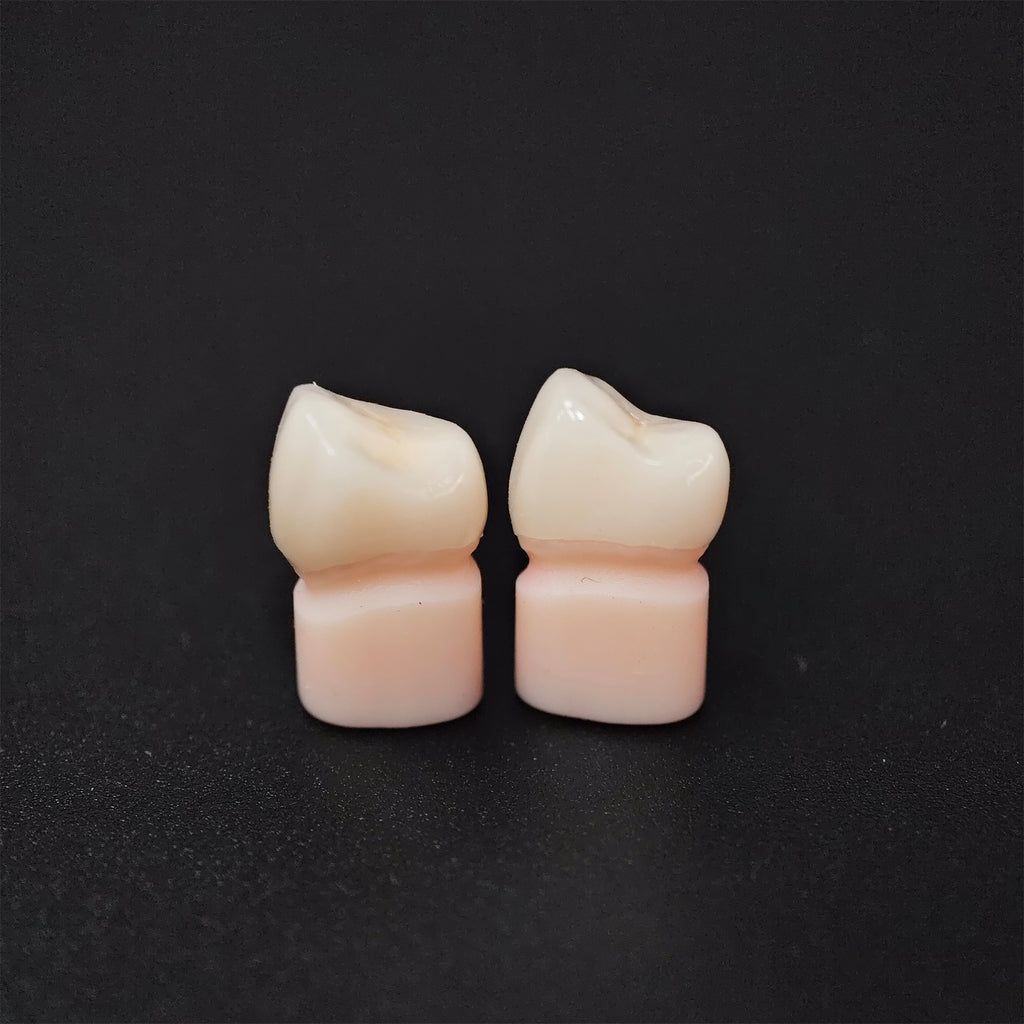 High - Strength Zirconia Crowns