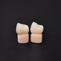High - Strength Zirconia Crowns