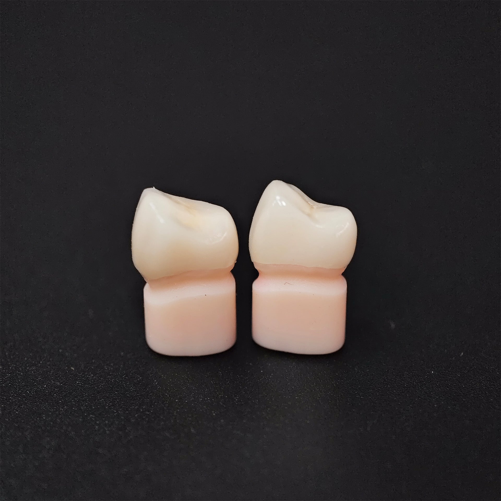 High - Strength Zirconia Crowns