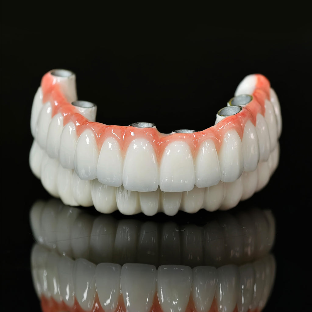 Implant-supported Co - Cr PFM Dental Bridge
