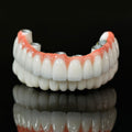 Implant-supported Co - Cr PFM Dental Bridge