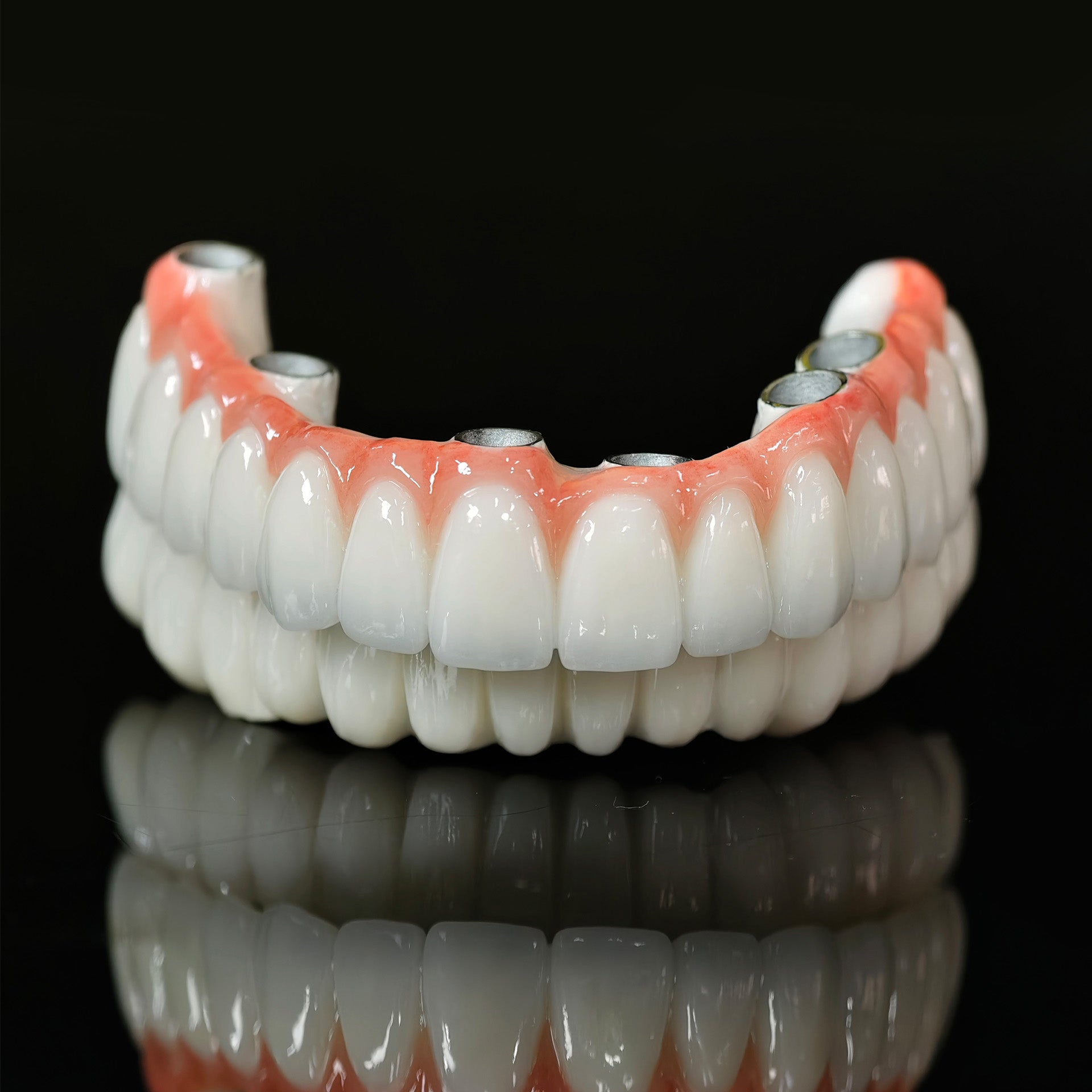 Implant-supported Co - Cr PFM Dental Bridge