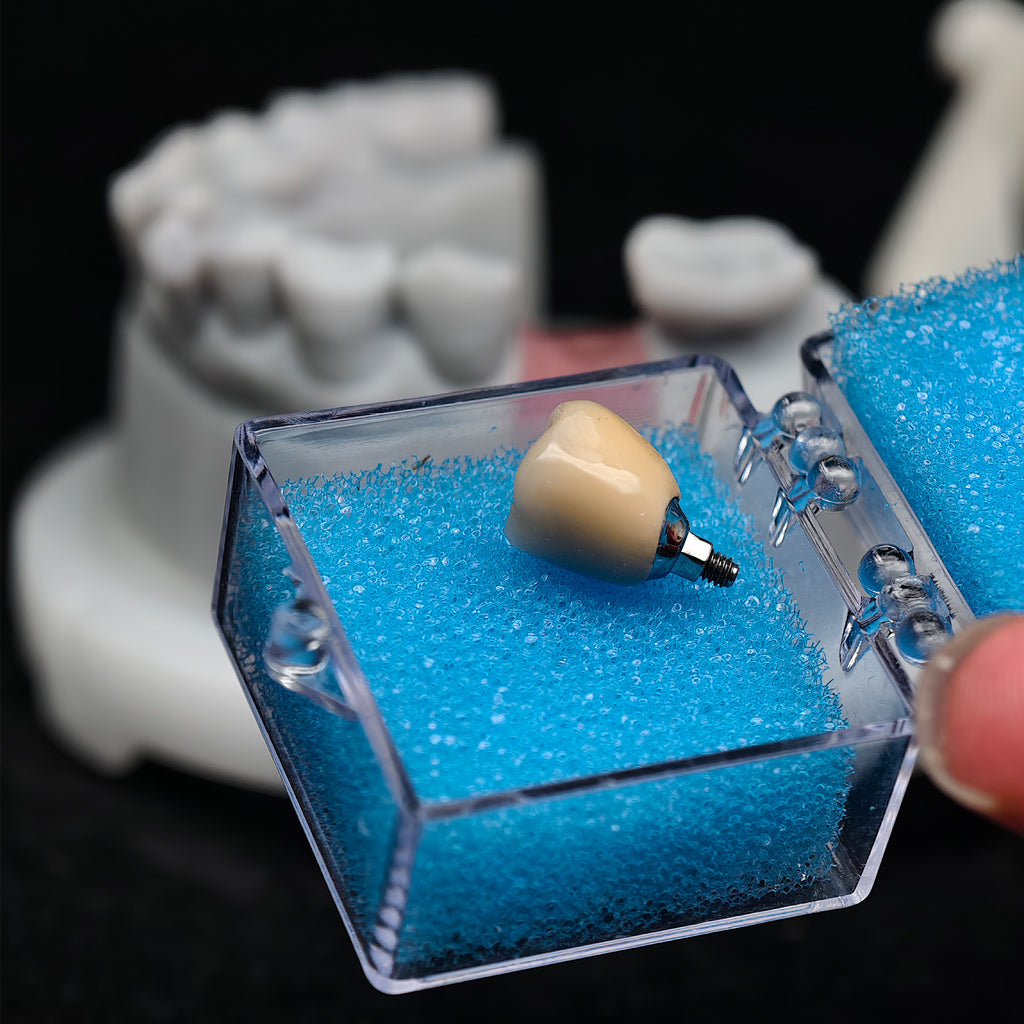 Implant-Supported PFM Single Crown