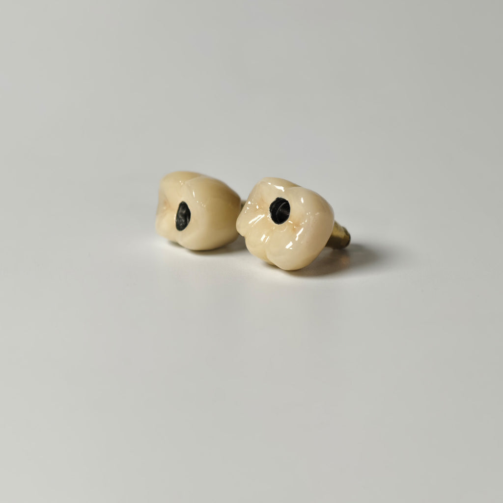 Implant-Supported PFM Single Crowns
