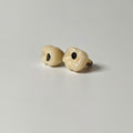 Implant-Supported PFM Single Crowns