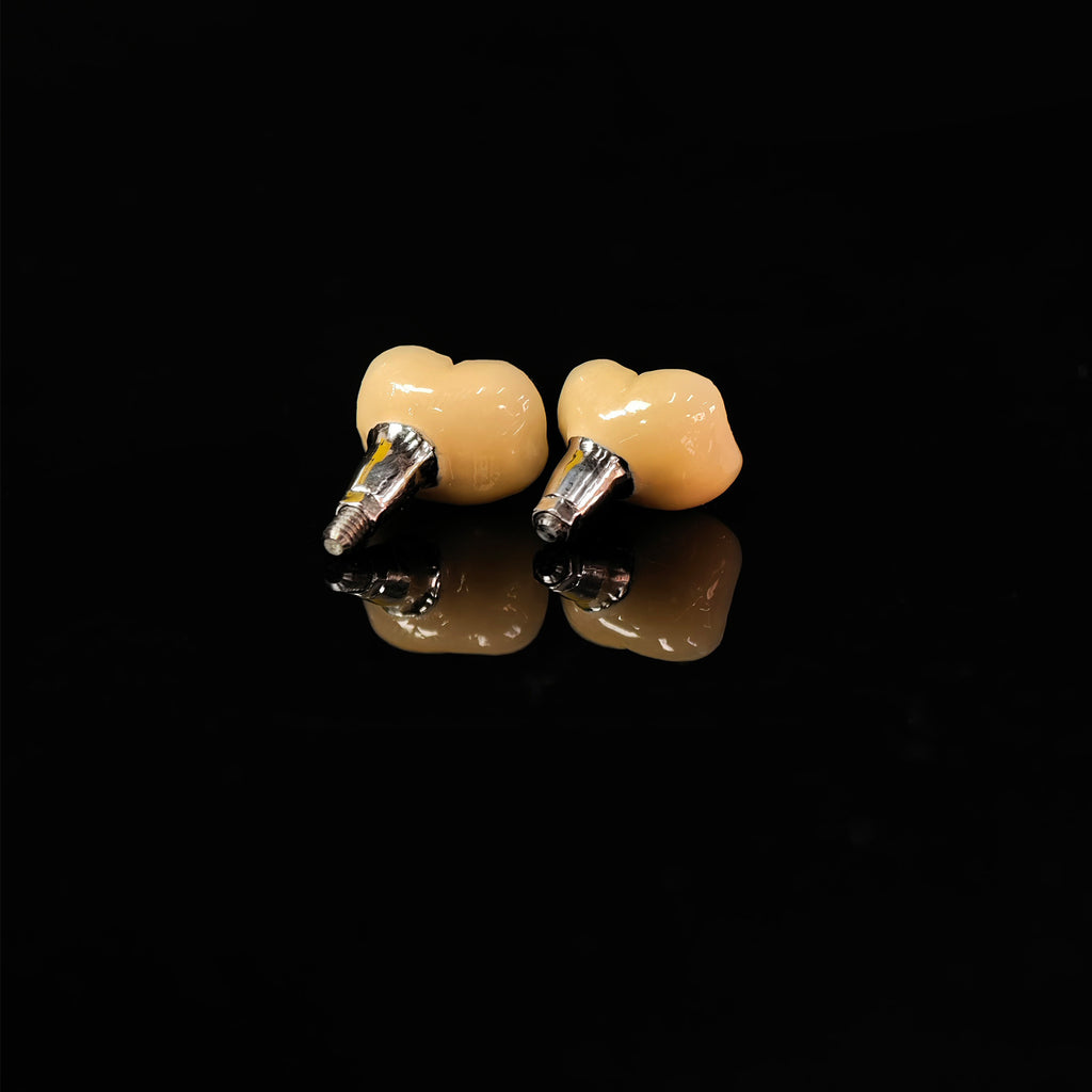 Implant-Supported PFM Single Crowns